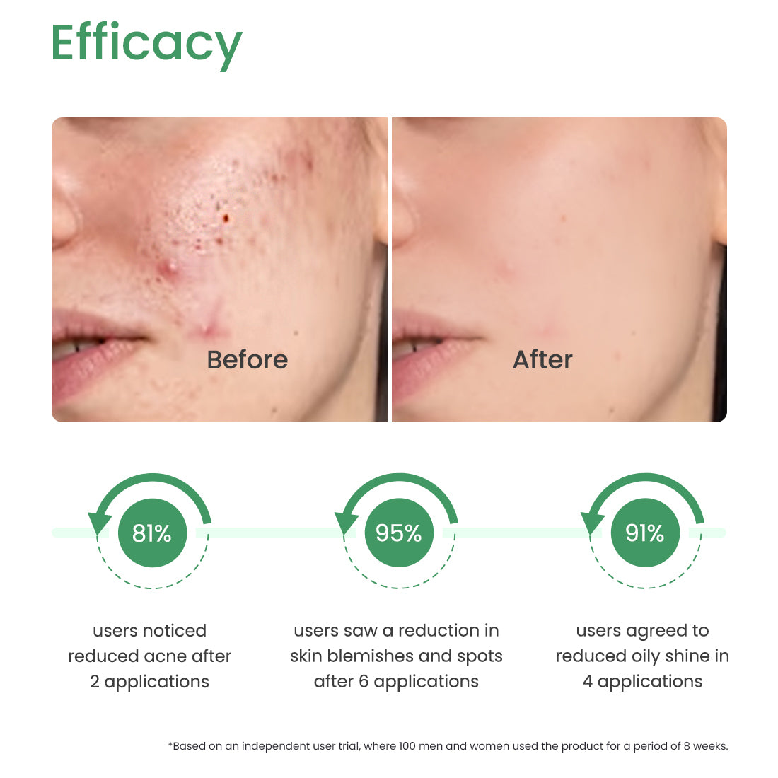 2% SALICYLIC ACID - SEBUM CONTROL SERUM