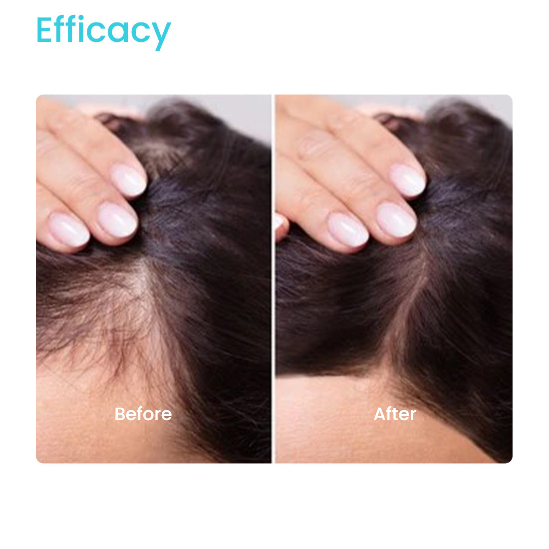 TAMANU VITAMIN E HAIR OIL