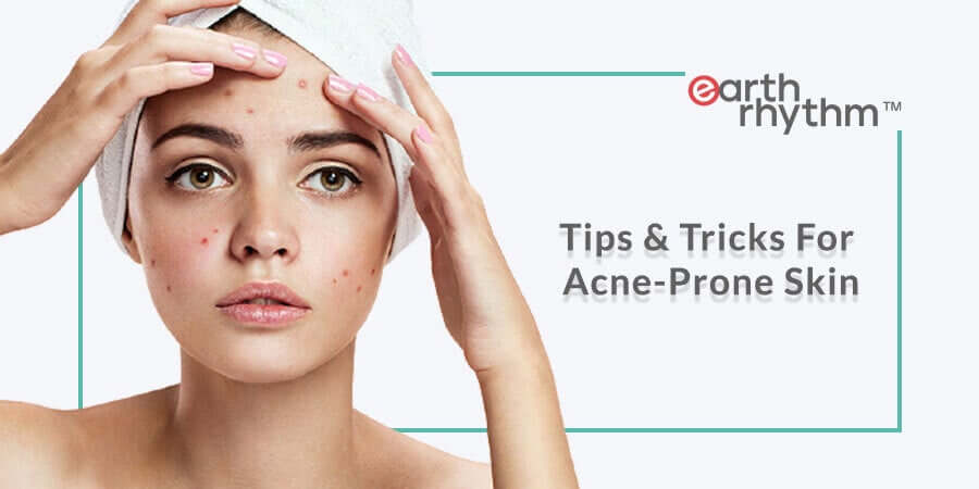 5 Best Tips For Acne-Prone Skin