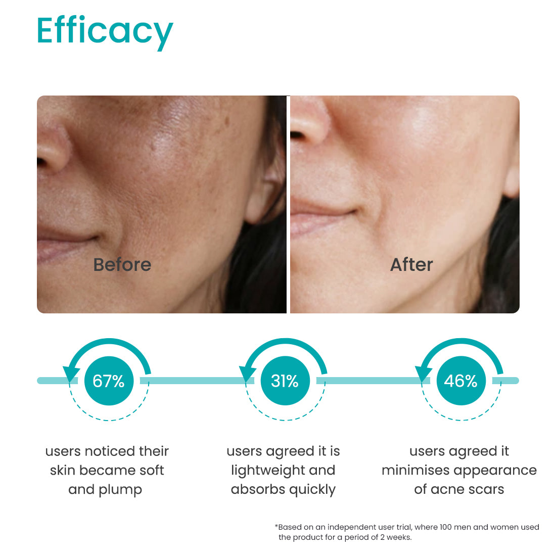 Best Nettle Oil For Healthy Skin & Hair Earth Rhythm