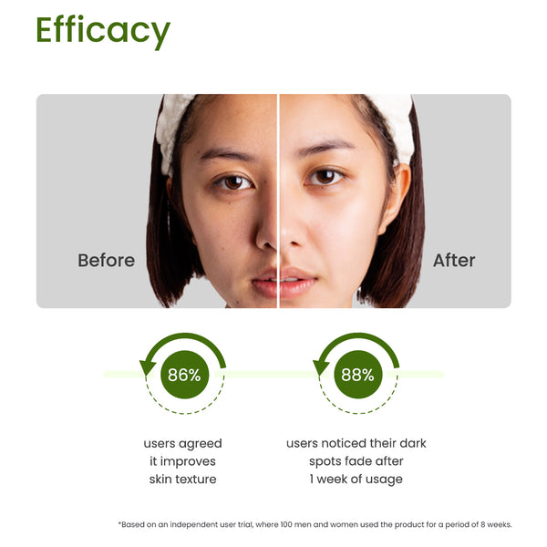10% AZELAIC ACID - SKIN BRIGHTENING FACE SERUM - 30ML