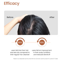 EXFOLIATING SHAMPOO BAR WITH 2% SALICYLIC ACID, WHITE WILLOW BARK & TOMATO FRUIT FERMENT