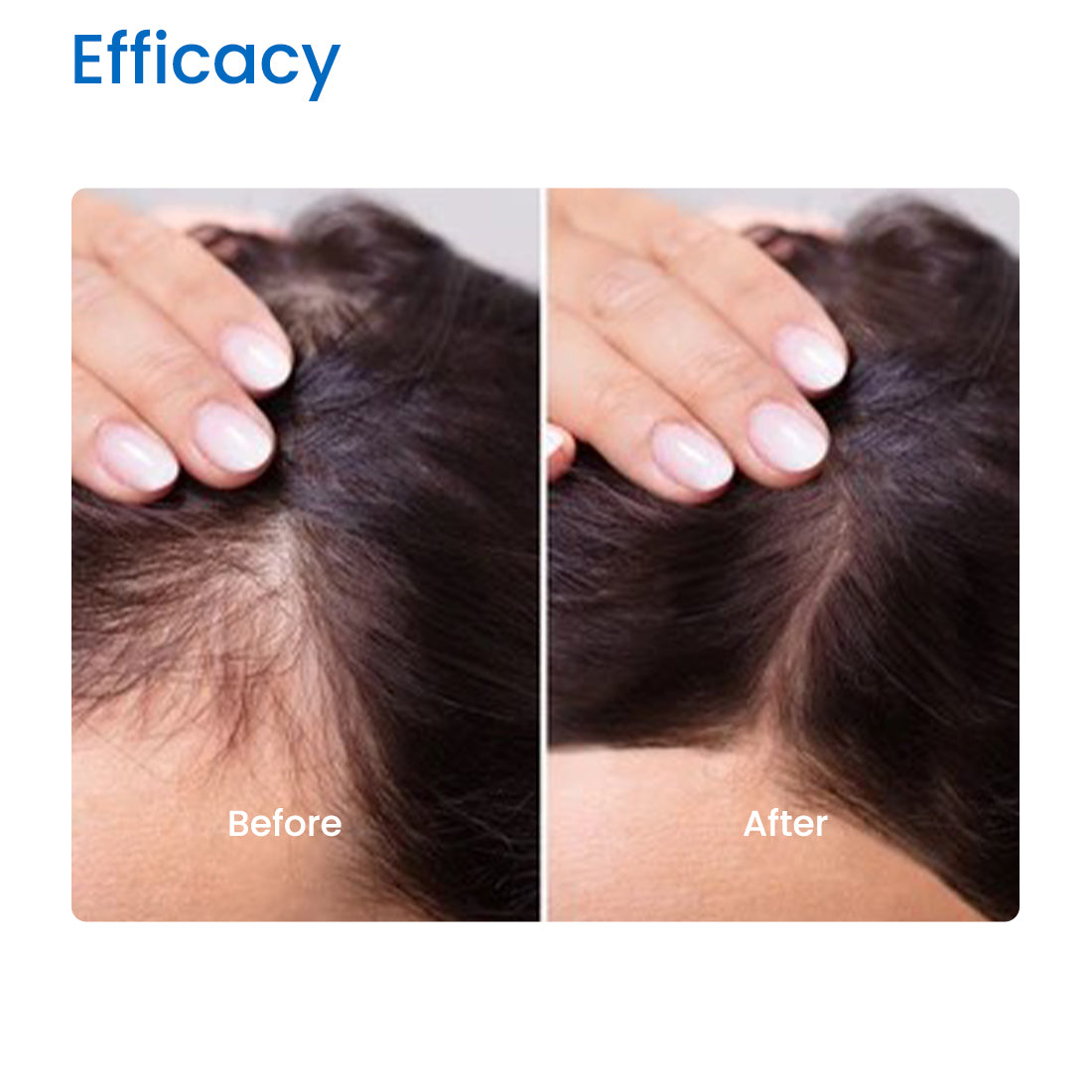 vitamin e hair oil for hairfall – Sassilicious