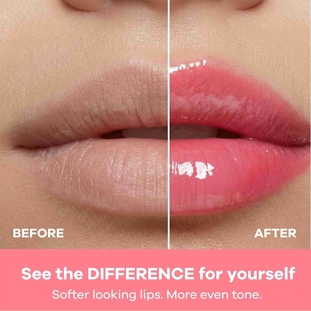 Honey Lip Balm SPF 50 Brightens Lips with Propolis,Peptides & Kojic Acid- 10 gm